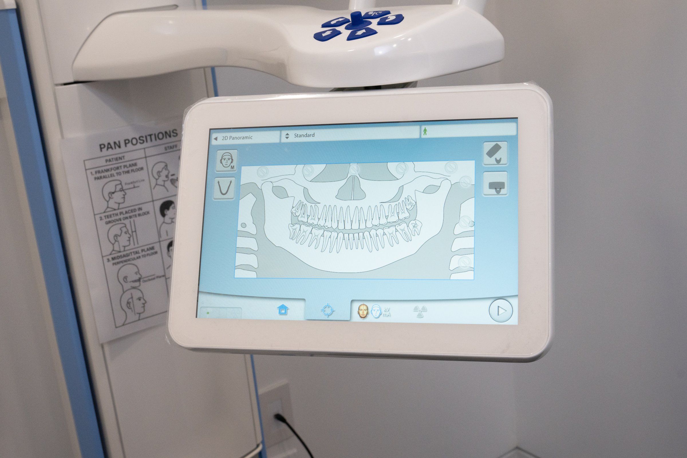 CBCT scanner screen showing a 3D dental scan