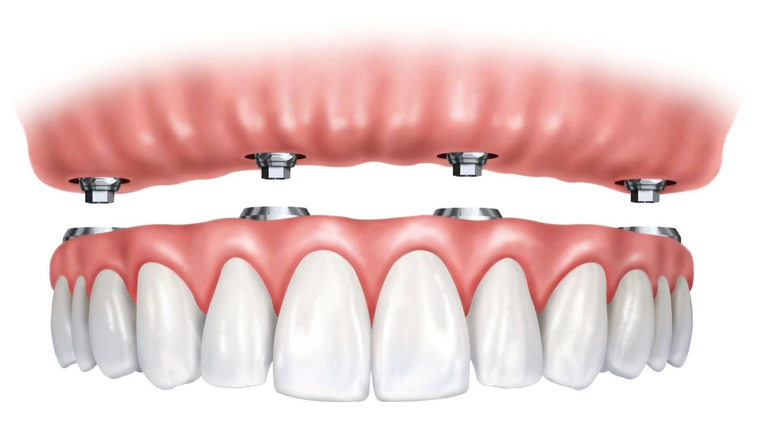 service illustration