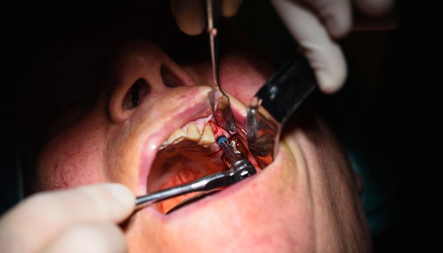 service illustration