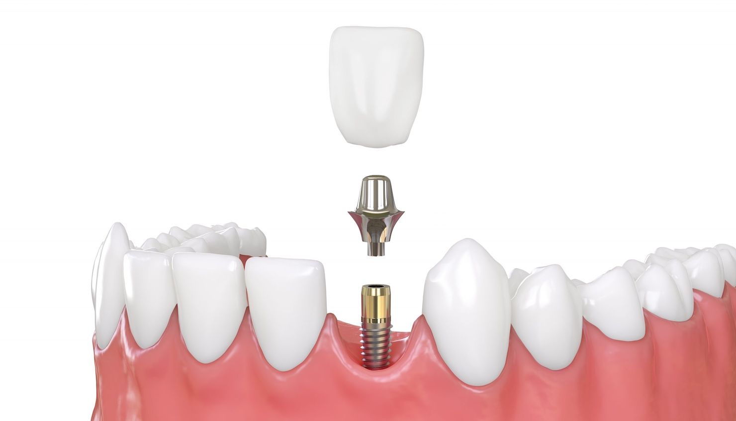 service illustration